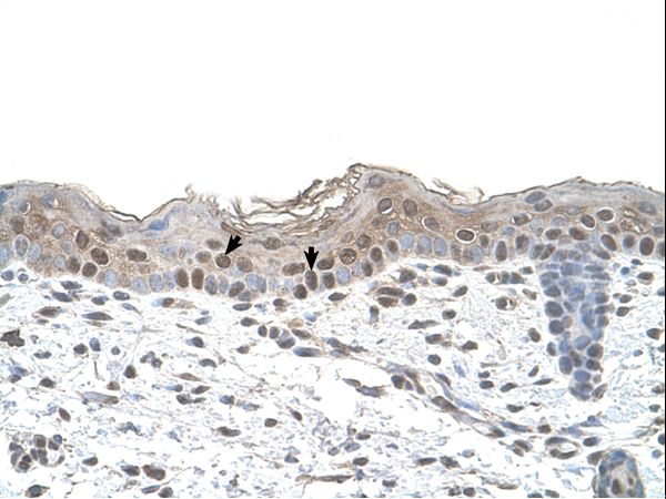 ARRB2 / Beta-Arrestin 2 antibody LS-C81143 was used in IHC to stain formalin-fixed, paraffin-embedded human skin.