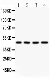 AAMP antibody Western blot. All lanes: Anti AAMP at 0.5 ug/ml. Lane 1: A431 Whole Cell Lysate at 40 ug. Lane 2: HELA Whole Cell Lysate at 40 ug. Lane 3: HEPG2 Whole Cell Lysate at 40 ug. Lane 4: MCF-7 Whole Cell Lysate at 40 ug. Predicted band size: 47 kD. Observed band size: 47 kD.