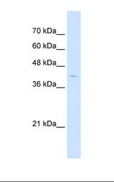 HepG2 cell lysate. Antibody concentration: 1.0 ug/ml. Gel concentration: 12%.