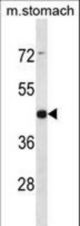 ARRDC1 Antibody western blot of mouse stomach tissue lysates (35 ug/lane). The ARRDC1 antibody detected the ARRDC1 protein (arrow).