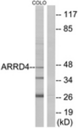 Western blot of extracts from COLO cells, using ARRD4 Antibody. The lane on the right is treated with the synthesized peptide.