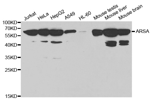 Western blot analysis of extracts of various cell lines, using ARSA antibody.
