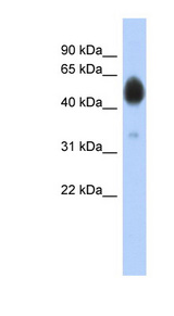 ARSA antibody LS-C111568 Western blot of COLO205 cell lysate.