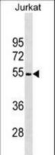 ARSA Antibody western blot of Jurkat cell line lysates (35 ug/lane). The ARSA antibody detected the ARSA protein (arrow).