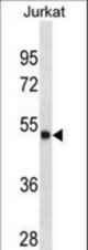 ARSA Antibody western blot of Jurkat cell line lysates (35 ug/lane). The ARSA antibody detected the ARSA protein (arrow).