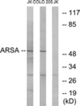 Western blot of extracts from Jurkat/COLO cells, using ARSA Antibody. The lane on the right is treated with the synthesized peptide.
