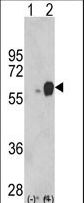 Western blot of ARSB (arrow) using rabbit polyclonal ARSB Antibody. 293 cell lysates (2 ug/lane) either nontransfected (Lane 1) or transiently transfected with the ARSB gene (Lane 2) (Origene Technologies).