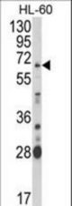 Western blot of ARSB Antibody in HL-60 cell line lysates (35 ug/lane). ARSB (arrow) was detected using the purified antibody.