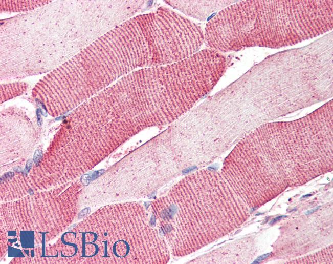 Anti-ARSB antibody IHC of human skeletal muscle. Immunohistochemistry of formalin-fixed, paraffin-embedded tissue after heat-induced antigen retrieval. Antibody LS-B2300 concentration 5 ug/ml.
