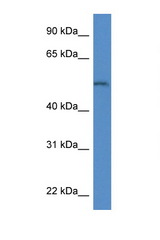 ARSB antibody LS-C145288 Western blot of Mouse Kidney lysate. Antibody concentration 1 ug/ml.