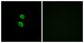 Immunofluorescence of MCF7 cells, using ARSD Antibody. The picture on the right is treated with the synthesized peptide.