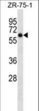 ARSD Antibody western blot of ZR-75-1 cell line lysates (35 ug/lane). The ARSD antibody detected the ARSD protein (arrow).