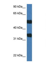 ARSG antibody LS-C145233 Western blot of Mouse Spleen lysate. Antibody concentration 1 ug/ml.