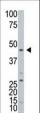 Western blot of ART3 Antibody in HL60 cell line lysates (25 ug/lane). ART3(arrow) was detected using the purified antibody (4 ug/ml).