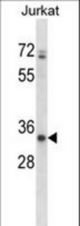 ART3 Antibody western blot of Jurkat cell line lysates (35 ug/lane). The ART3 antibody detected the ART3 protein (arrow).