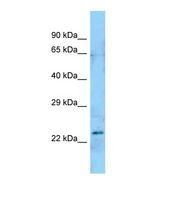 Western blot of Human Jurkat. ART5 antibody dilution 1.0 ug/ml.