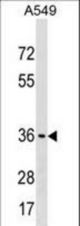 ART5 Antibody western blot of A549 cell line lysates (35 ug/lane). The ART5 antibody detected the ART5 protein (arrow).