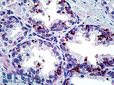 Anti-ARTN / Artemin antibody IHC of human prostate. Immunohistochemistry of formalin-fixed, paraffin-embedded tissue after heat-induced antigen retrieval. Antibody LS-B5083 concentration 10 ug/ml.