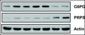 Role of PPP during MSC transformation. (A) G6PD activity decreased during MSC transformation (&#8727;, P=0.0132; t test). Western blot confirms the down-regulation of G6PD and the up-regulation of PRPS at the late stages of transformation.