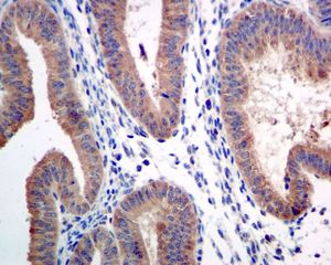 IHC of paraffin-embedded human uterus tissue using anti-ERAP1 antibody.