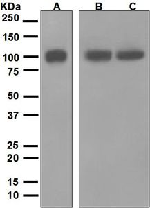 Western blot analysis on (A) K562, (B) HUVEC, and (C) A431 cell lysates using anti-ERAP1 antibody.