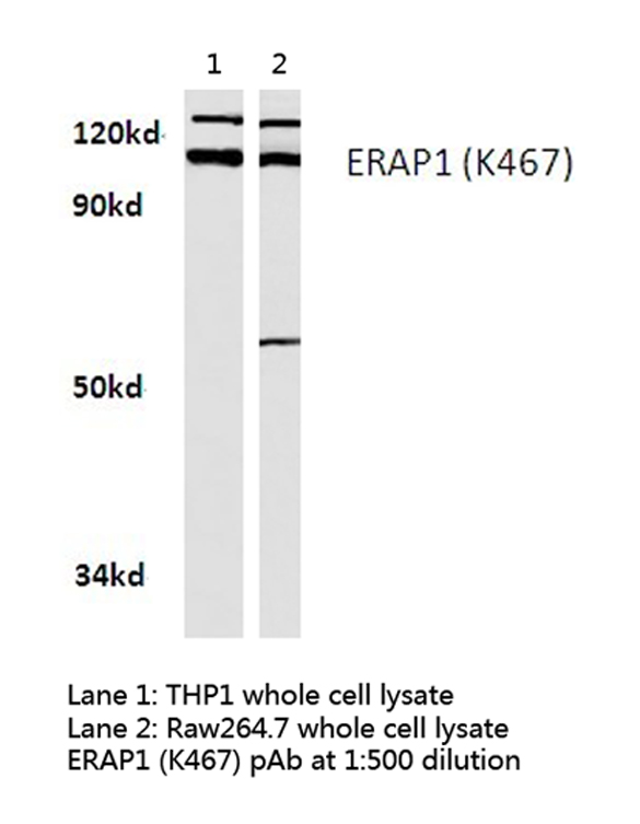 Western blot of ERAP1 (K467) pAb in extracts from THP1 and raw264.7 cells.