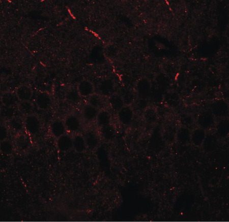 Immunofluorescence of ERAP1 in mouse brain tissue with ERAP1 antibody at 20 ug/ml.
