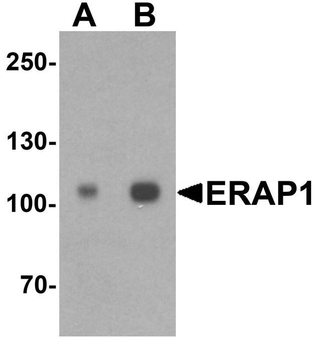 Western blot analysis of ERAP1 in SK-N-SH cell lysate with ERAP1 antibody at (A) 1 and (B) 2 ug/ml.