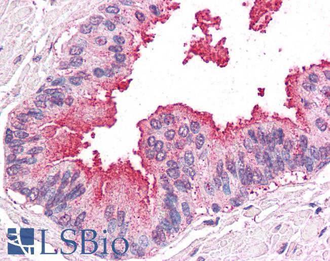 Anti-ERAP1 / ARTS1 antibody LS-A8946 IHC of human prostate. Immunohistochemistry of formalin-fixed, paraffin-embedded tissue after heat-induced antigen retrieval.