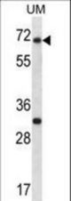 Arx Antibody (Human N-term) western blot of human Uterine tumor tissue lysates (35 ug/lane). The Arx antibody detected the Arx protein (arrow).