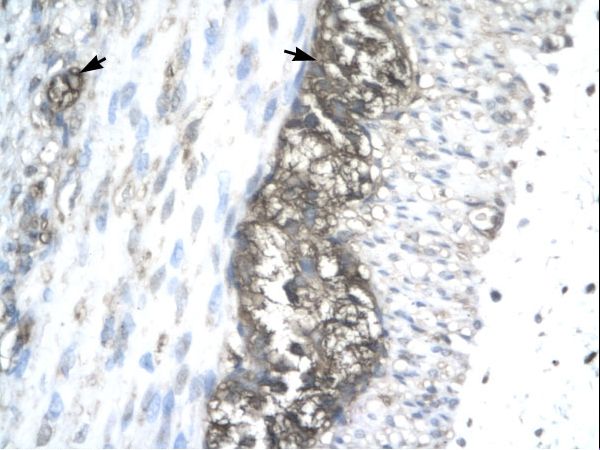 ACAT2 antibody LS-C30948 was used in IHC to stain formalin-fixed, paraffin-embedded human stomach.