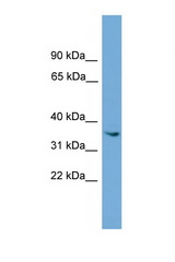 ASB17 antibody LS-C116490 Western blot of ACHN Cell lysate. Antibody concentration 1 ug/ml.