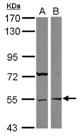 Sample (30 ug of whole cell lysate) A: 293T B: Raji 7.5% SDS PAGE ASB3 antibody diluted at 1:1000