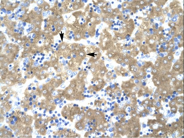 ACAT2 antibody LS-C30947 was used in IHC to stain formalin-fixed, paraffin-embedded human liver.