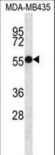 ASB4 Antibody western blot of MDA-MB435 cell line lysates (35 ug/lane). The ASB4 antibody detected the ASB4 protein (arrow).