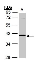 Sample (30g whole cell lysate). A: A431. 10% SDS PAGE. ASB4 antibody diluted at 1:1000