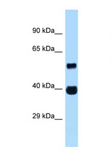 ASB4 antibody LS-C145355 Western blot of Fetal Heart lysate. Antibody concentration 1 ug/ml.