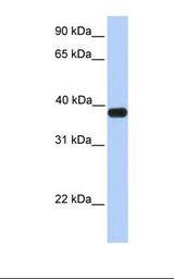 Fetal muscle lysate. Antibody concentration: 1.0 ug/ml. Gel concentration: 12%.