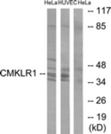 Western blot of extracts from HeLa/HUVEC cells, using CMKLR1 Antibody. The lane on the right is treated with the synthesized peptide.