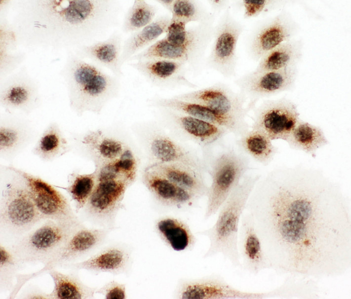 DDX4 / VASA antibody. ICC: MCF-7 Cell.