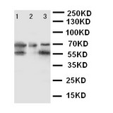 WB of DDX4 / VASA antibody. Lane 1: Rat Testis Tissue Lysate. Lane 2: Mouse Testis Tissue Lysate. Lane 3: HELA Cell Lysate.