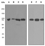 Western blot analysis on (A) human testis, (B) human ovary cancer, (C) K562, (D) seminoma, (E) HeLa, (F) NCCIT and (G) LNCaP cell lysates using anti-DDX4 antibody.