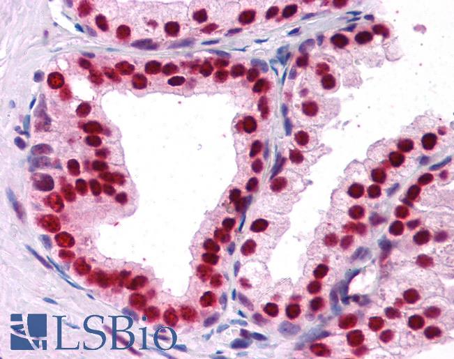 Anti-DDX5 antibody IHC of human prostate. Immunohistochemistry of formalin-fixed, paraffin-embedded tissue after heat-induced antigen retrieval. Antibody LS-B3931 concentration 2.5 ug/ml.
