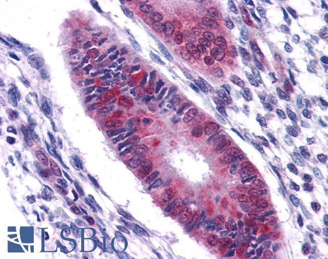 Anti-DDX5 antibody IHC of human uterus. Immunohistochemistry of formalin-fixed, paraffin-embedded tissue after heat-induced antigen retrieval. Antibody LS-B3931 concentration 2.5 ug/ml.