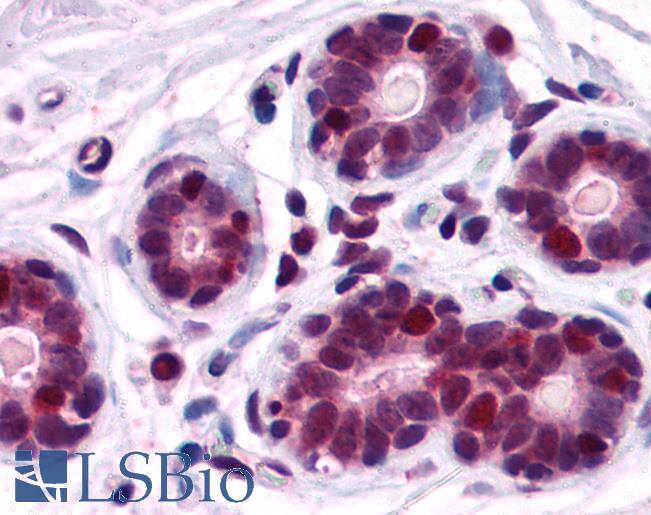 Anti-DDX5 antibody IHC of human breast. Immunohistochemistry of formalin-fixed, paraffin-embedded tissue after heat-induced antigen retrieval. Antibody LS-B3931 concentration 2.5 ug/ml.