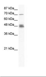 Jurkat Cell Lysate