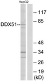 Western blot of extracts from HepG2 cells, using DDX51 Antibody. The lane on the right is treated with the synthesized peptide.