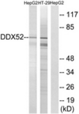 Western blot of extracts from HepG2/HT-29 cells, using DDX52 Antibody. The lane on the right is treated with the synthesized peptide.
