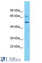 DDX52 antibody Western Blot of Uterus tumor. Antibody dilution: 1 ug/ml.