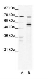 A: Marker, B: HepG2 Cell Lysate